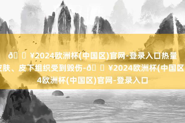 🔥2024欧洲杯(中国区)官网-登录入口热量蕴蓄容易导致皮肤、皮下组织受到毁伤-🔥2024欧洲杯(中国区)官网-登录入口